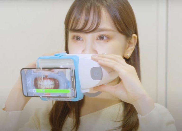 歯ならび見守りアプリ