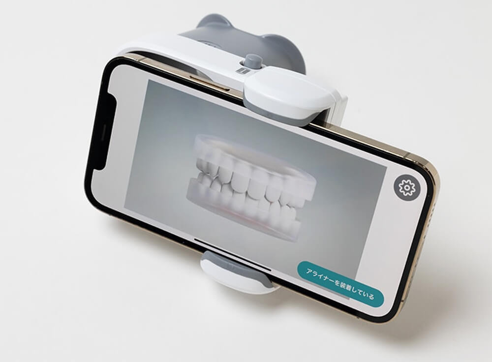 効率的な矯正治療のための「Dental Monitoring(デンタルモニタリング)」を導入