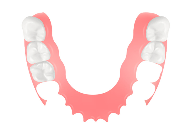 フィンデンジャー